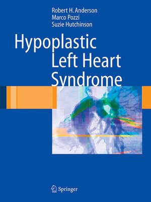 cover image of Hypoplastic Left Heart Syndrome